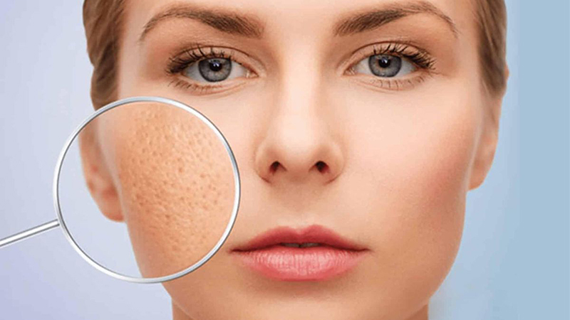 Tại Sao Càng Dưỡng Da Thì Càng Bị Đổ Dầu Và Lỗ Chân Lông To Vật Vã?