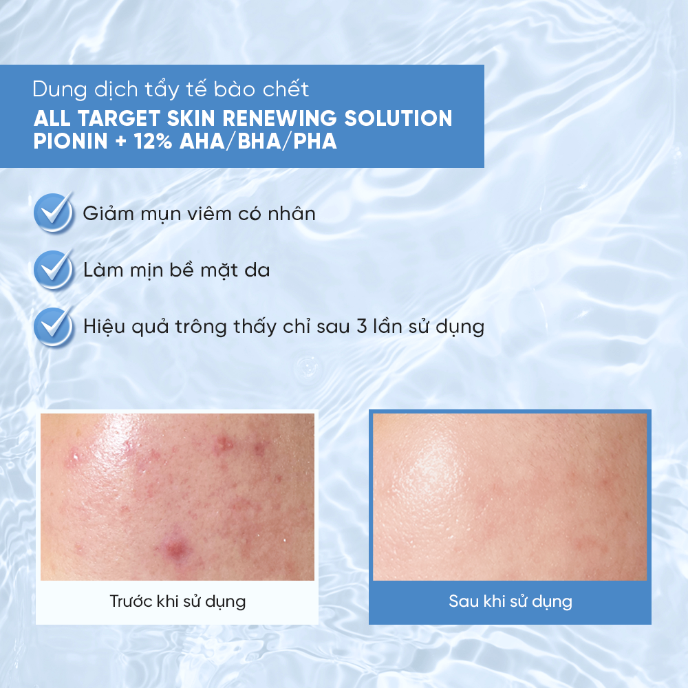 Hiệu quả của Emmié All Target Skin Renewing Solution Pionin + 12% AHA/BHA/PHA