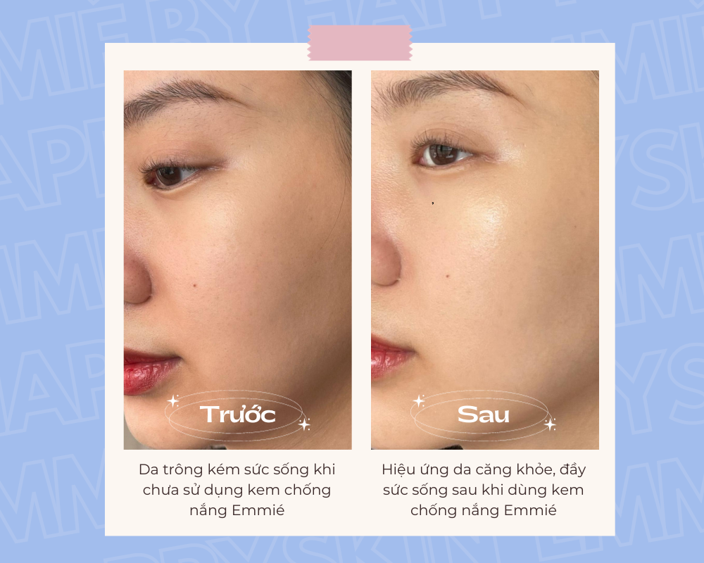 Hiệu quả trên da trước và sau khi sử dụng kem chống nắng Emmié